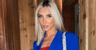 Megan McKenna looks stunning after ditching lip fillers for more natural look