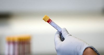 New blood test could detect cancer before symptoms appear