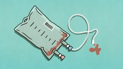 Doctors warn against unnecessary blood transfusions in Australian hospitals as donations decline