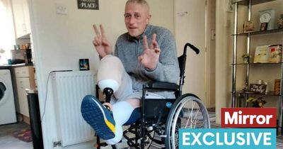 Man has both legs amputated after miraculously surviving five days impaled on fence