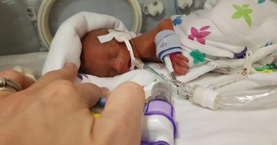 Mum’s moving tribute to ‘feisty’ premature son who even in death is proving an inspiration