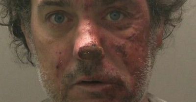 Man set partner on fire and left her unrecognisable with horrific injuries