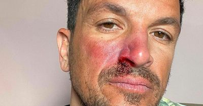 Peter Andre worries fans with snap of bloody nose - but not all is as it seems