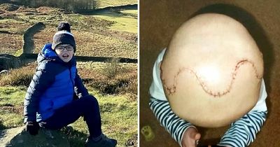 Schoolboy whose skull was put back together 'like a jigsaw' now taking on triathlon