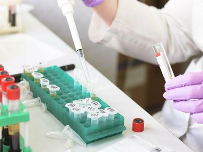 Why Creative Medical Technology Shares Are Soaring