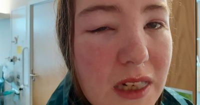 Yate mum speaks of daughter's 'awful' health battle six years after mosquito bite