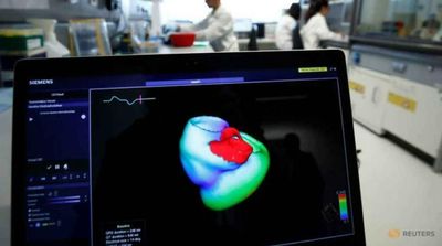 New Program Could Predict Heart Attack Five Years before it Occurs