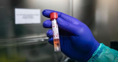 Covid infection rates for all 32 Scots councils as Public Health Scotland confirm 10,100 new cases