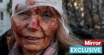 Ukraine teacher left bloodied and bandaged by Russian airstrikes is safe at last