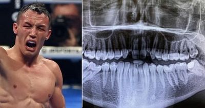 Josh Warrington suffers broken jaw in world title win over Kiko Martinez