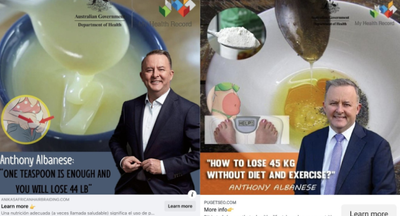 The mystery behind Facebook ads showing Anthony Albanese spruiking weight-loss supplements