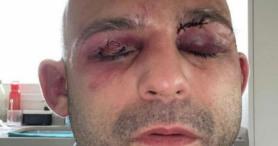 Kiko Martinez shares gruesome photo of battered face after Josh Warrington fight