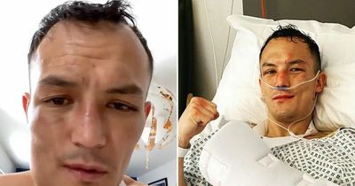 Josh Warrington faces two weeks on liquid diet after breaking jaw in Kiko Martinez fight