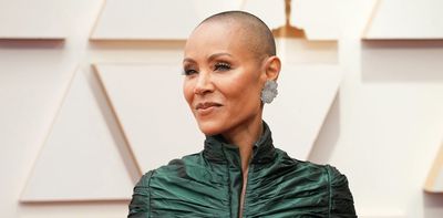 What is alopecia? It's no laughing matter for millions of Black American women