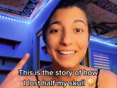 Woman left with half a skull after sinus infection