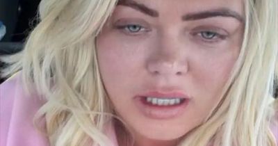 Gemma Collins rushes to dentist to have tooth removed days before Chicago rehearsals