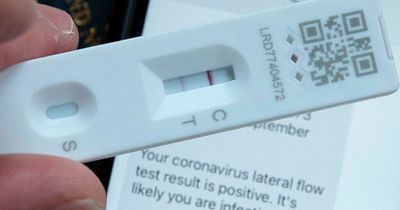 Experts say if you've had Covid you're at greater risk of developing 19 conditions