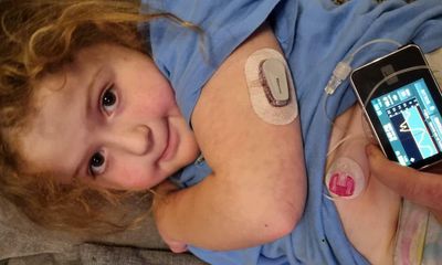 Hundreds fitted with artificial pancreas in NHS type 1 diabetes trial