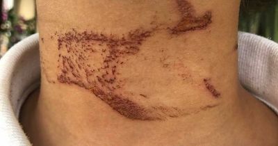 Girl, 10, choked by dog lead after out of control bulldog bolts towards her at park