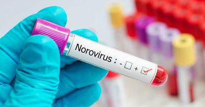 How norovirus spreads and six key symptoms to look out for as cases rise