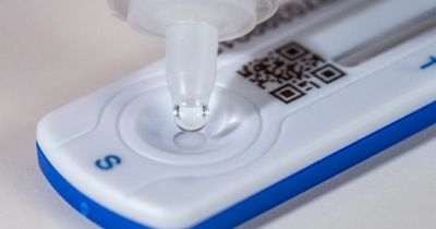 Top immunologist explains why some people don't catch Covid-19