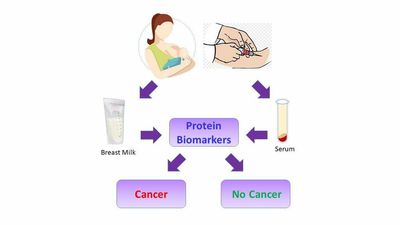 Breast Cancer Screening Could Be Done Via A Blood Test In Future Following Milk Discovery