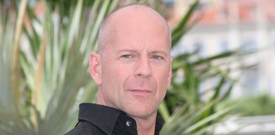Bruce Willis's aphasia diagnosis draws attention to a common cognitive disorder
