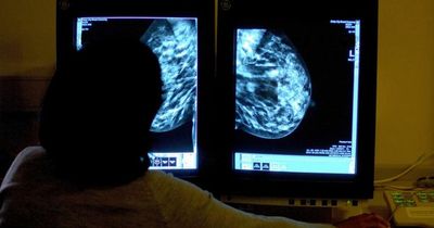 MPs warn cancer survival rate in England at risk of going into ‘reverse’