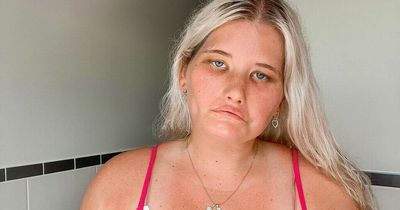 Woman born unable to smile longed to be 'normal' but now is proud to 'stand out'