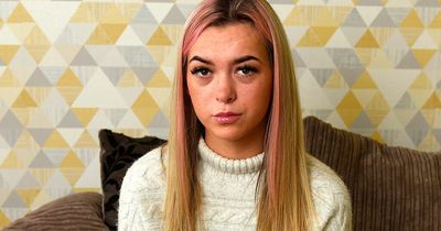 Young woman scarred for life by ex-boyfriend hits out after abuser escapes jail