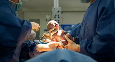 Too posh to push: Why we must call time on damaging anti-caesarean birth stigma