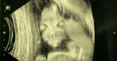 Mum scared of unborn 'demon child' as baby looks like 'Salad Fingers' in scan