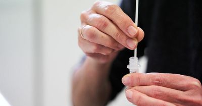 Pharmacist shares when you should take an LFT as Scotland to scrap home kits