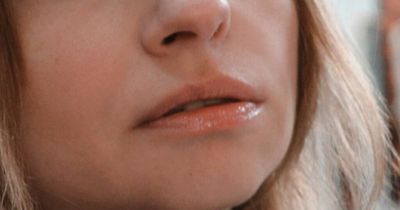 Diabetes: Symptoms and warning signs in your mouth that suggest high blood sugar