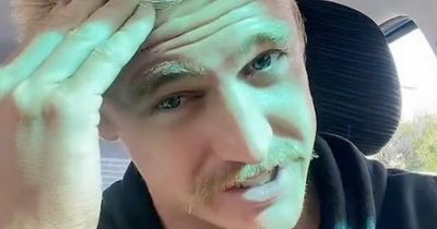 Balding man said his hair grew back when he stopped washing it