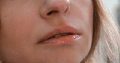 Diabetes symptoms in mouth that may indicate high blood sugar