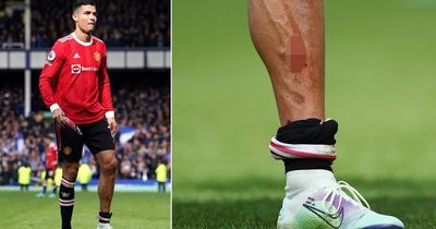 Cristiano Ronaldo shows off bloody and wounded leg as Man Utd star limps down tunnel