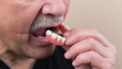 Dental reforms to look after older people unable to access care needed, advocates say