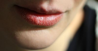 Diabetes mouth symptoms that may indicate high blood sugar revealed