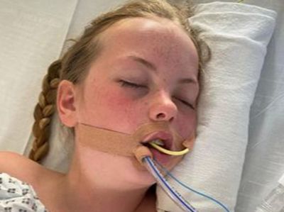 Schoolgirl left in coma after ‘doctors dismissed meningitis symptoms as common cold’