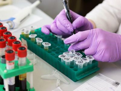 Why Altamira Therapeutics Stock Is Soaring