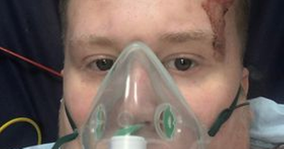 Scots teen left 'impaled' on garden fence after horror bike fall