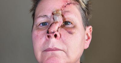 Woman's horrific scars after mauling by dog she was told was safe to pet