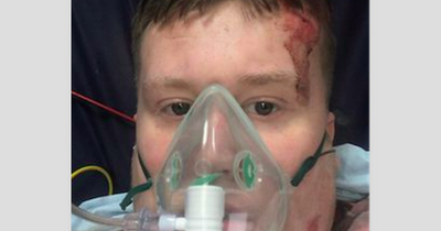Teenager impaled on garden fence in horrific freak bike accident