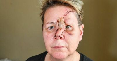Woman left with horrific facial injuries after being mauled by dog in the street