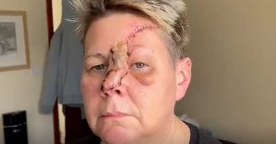 Woman’s horrific scars after mauling by dog who's owner said was safe to clap