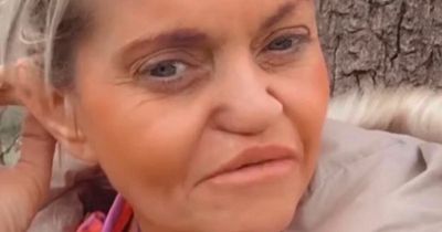 Danniella Westbrook goes make-up free to the park after hitting out at surgery reports