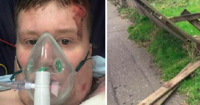 Lanarkshire teen left impaled on post after crashing bike into broken garden fence