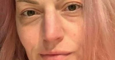 Woman claims rare reaction to Covid jab saw her 'age 20 years in three days'