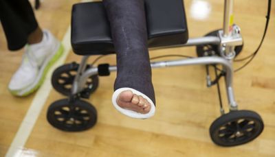 For weekend warriors, most Achilles tendon ruptures heal as well without surgery, study finds